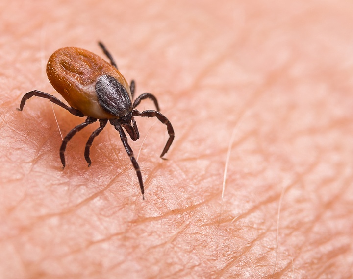 Lyme Disease Treatment California Center for Functional Medicine