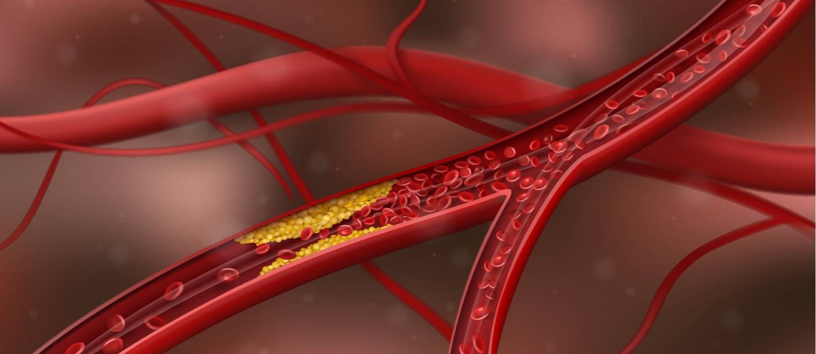 Functional Markers That Reveal Your True Cardiac Risk