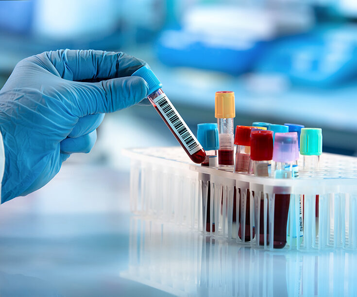 What Your Labs Can Tell You About Your Longevity Trajectory